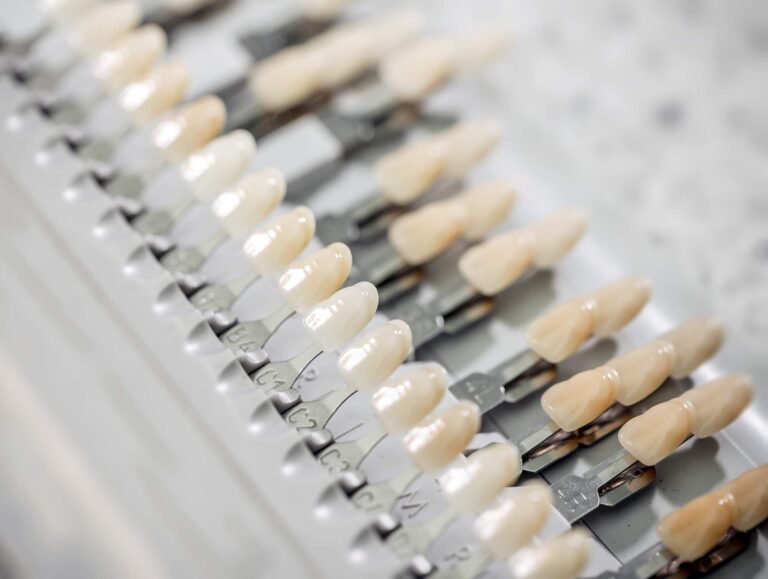 Implanty w Lublinie - jak o nie dbać? Robienie przeglądu